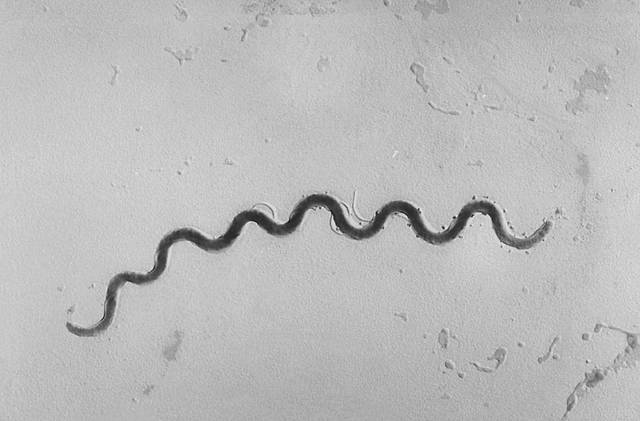 Cases of newborns with syphilis doubles in four years - CDC