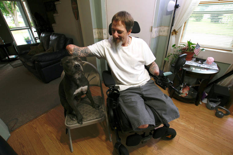 ASSOCIATED PRESS
                                Greg Manteufel petted his dog Ellie, Aug. 16, at his home in West Bend, Wis. Manteufel lost parts of his arms and legs, as well as the skin of his nose and part of his upper lip from capnocytophaga, a bacteria commonly found in the saliva or cats and dogs that almost never leads to people getting sick, unless the person has a compromised immune system.