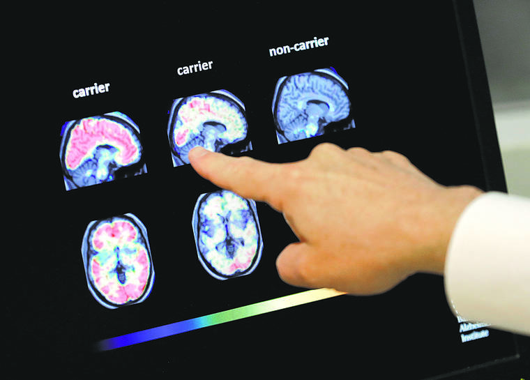 ASSOCIATED PRESS
                                Dr. William Burke goes over a PET brain scan at Banner Alzheimers Institute in Phoenix.