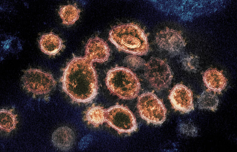 NIAID-RML VIA ASSOCIATED PRESS
                                A 2020 electron microscope image provided by the National Institute of Allergy and Infectious Diseases - Rocky Mountain Laboratories shows SARS-CoV-2 virus particles that cause COVID-19, isolated from a patient in the U.S., emerging from the surface of cells cultured in a lab. New York has found its first known case of a new variant of COVID-19 in upstate New York.