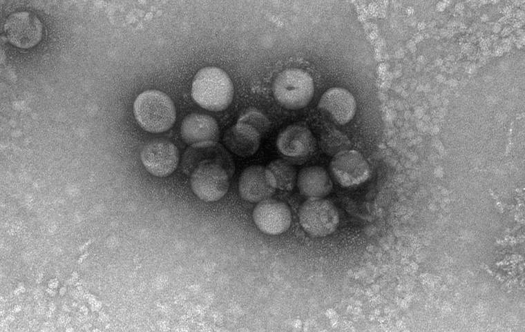 OHIO STATE UNIVERSITY’S MOLECULAR AND CELLULAR IMAGING CENTER VIA THE NEW YORK TIMES
                                A new canine coronavirus detected in a pneumonia patient hospitalized in Malaysia in 2018. If the virus is confirmed to be a human pathogen, it would be the eighth coronavirus, and the first canine coronavirus, known to cause disease in humans.