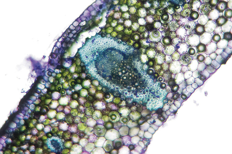 COURTESY JESSE ADAMS
                                Vascular bundles in a plant’s leaf, shown above in an image taken through a microscope, contain xylem. This is a network of tissues that helps transport water throughout the interior of the plant.