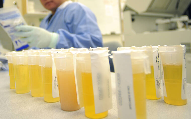 STAR-ADVERTISER FILE
                                A Diagnostic Laboratory Services lab assistant prepared to run pre-employment and workplace drug tests. Diagnostic Laboratory Services Inc. has temporarily closed several of its COVID-19 testing sites due to staffing shortages.