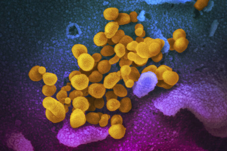 NIAID-RML VIA ASSOCIATED PRESS
                                The Novel Coronavirus SARS-CoV-2, seen in February 2020, indicated in yellow, emerging from the surface of cells, indicated in blue/pink, cultured in the lab. A U.K. patient with a severely weakened immune system had COVID-19 for almost a year and a half, scientists reported, underscoring the importance of protecting vulnerable people from the coronavirus.