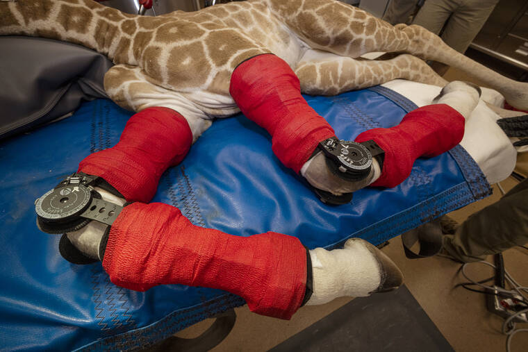 SAN DIEGO ZOO WILDLIFE ALLIANCE VIA ASSOCIATED PRESS
                                Msituni, a giraffe calf born with an unusual disorder that caused her legs to bend the wrong way, seen Feb. 10, in San Diego Zoo Safari Park in Escondido, north of San Diego. Msituni was fitted with custom-molded carbon graphite orthotic braces by using cast moldings of the calf’s legs that were crafted by Hanger Clinic at the zoo.