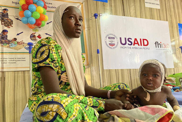 ASSOCIATED PRESS
                                A woman attends to her malnourished child at the United Nations Nutrition Center in Banki, on the outskirts of Maiduguri, Nigeria, on May 3.