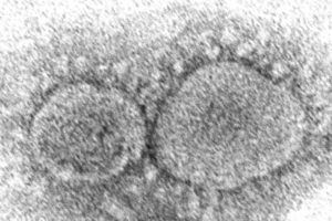 HANNAH A. BULLOCK, AZAIBI TAMIN/CDC VIA ASSOCIATED PRESS
                                This 2020 electron microscope image shows SARS-CoV-2 virus particles that cause COVID-19. The coronavirus mutant that just became dominant in the United States as of May 2022 is a member of the omicron family. But scientists say it spreads faster than its omicron predecessors, is adept at escaping immunity and might possibly cause more serious disease.