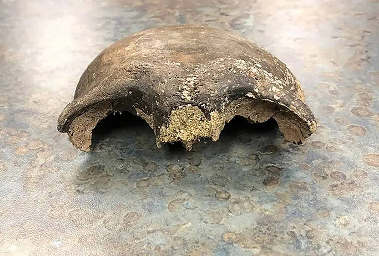 RENVILLE COUNTY SHERIFF’S OFFICE / NEW YORK TIMES
                                In an undated image provided by the Renville County Sheriff’s Office, part of a skull, believed to be about 8,000 years old, found in the Minnesota River in September 2021.
