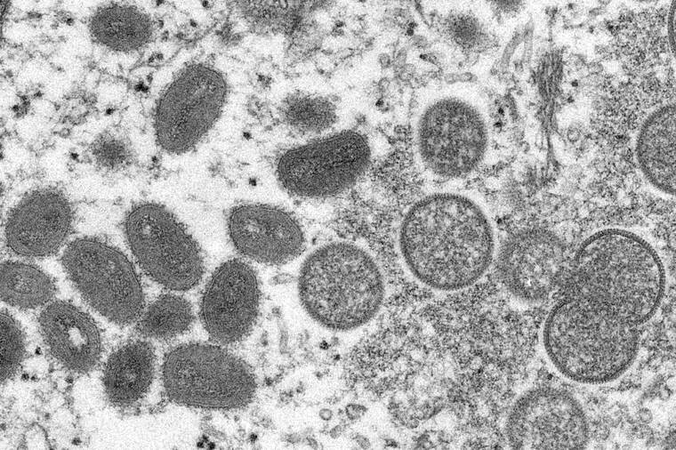 CYNTHIA S. GOLDSMITH, RUSSELL REGNER/CDC VIA ASSOCIATED PRESS
                                This 2003 electron microscope image shows mature, oval-shaped monkeypox virions, left, and spherical immature virions, right, obtained from a sample of human skin associated with the 2003 prairie dog outbreak. Genetic analysis of recent monkeypox cases suggests there are two distinct strains in the U.S., health officials said today, raising the possibility that the virus has been circulating undetected for some time.