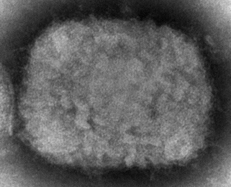 CDC VIA AP
                                This 2003 electron microscope image made available by the Centers for Disease Control and Prevention shows a monkeypox virion, obtained from a sample associated with the 2003 prairie dog outbreak. The U.S. government is building up its supply of monkeypox vaccine to contend with escalating cases identified in a surprising international outbreak, health officials said Friday.